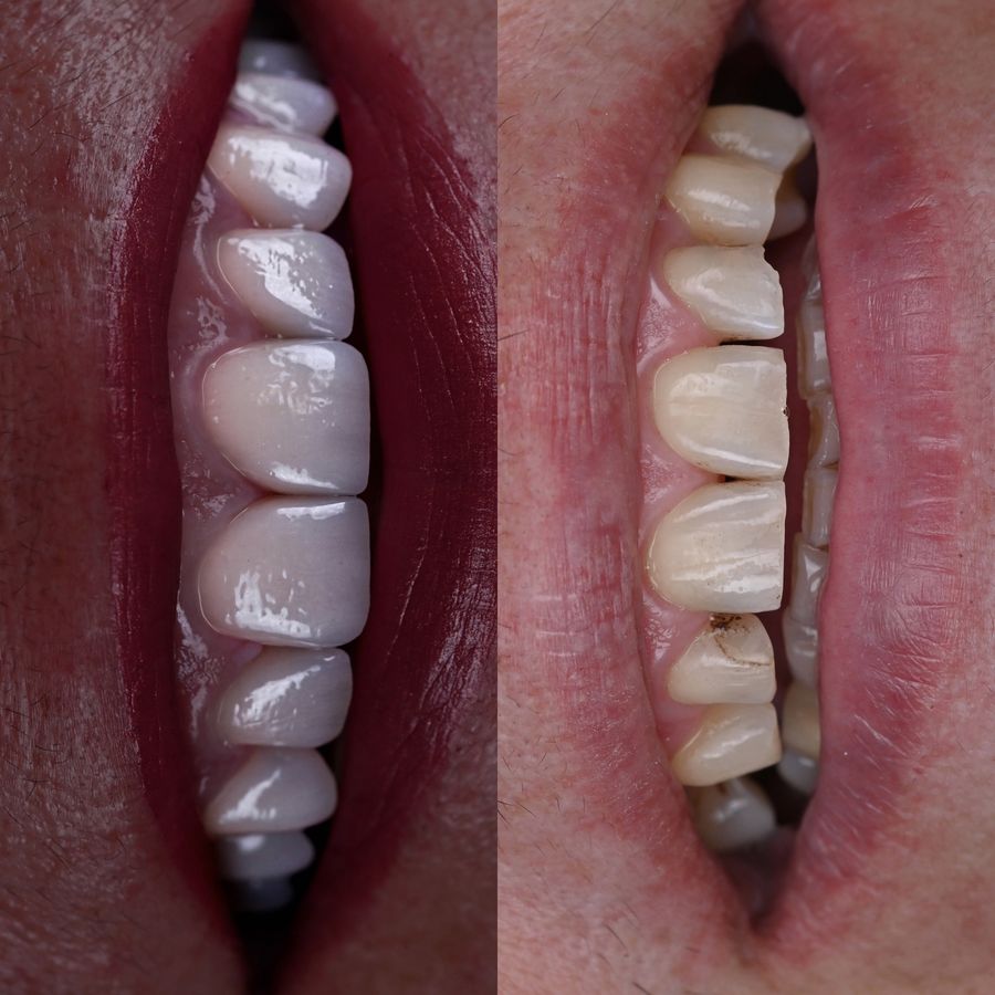 Ședință de familiarizare cu cabinetul Bel-Dent Baia Mare